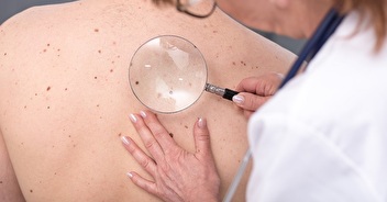 Semaine de prévention et de dépistage des cancers de la peau 2021