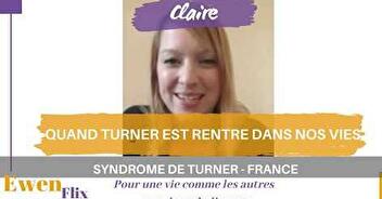 Le témoignage EwenLife de Claire sur le syndrome de Turner